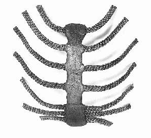 需要骨修復的患者越來越多，人工骨會是他們